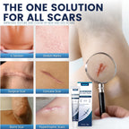 Lavender Scar Care & Repair Cream Set — Fade Marks & Restore Even Skin Tone