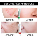 Intensive Skin Repair Cream — Barrier Restoration & Deep Healing Moisturiser