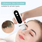Ultrasonic Skin Scrubber — Deep Pore Cleansing & Peeling Device