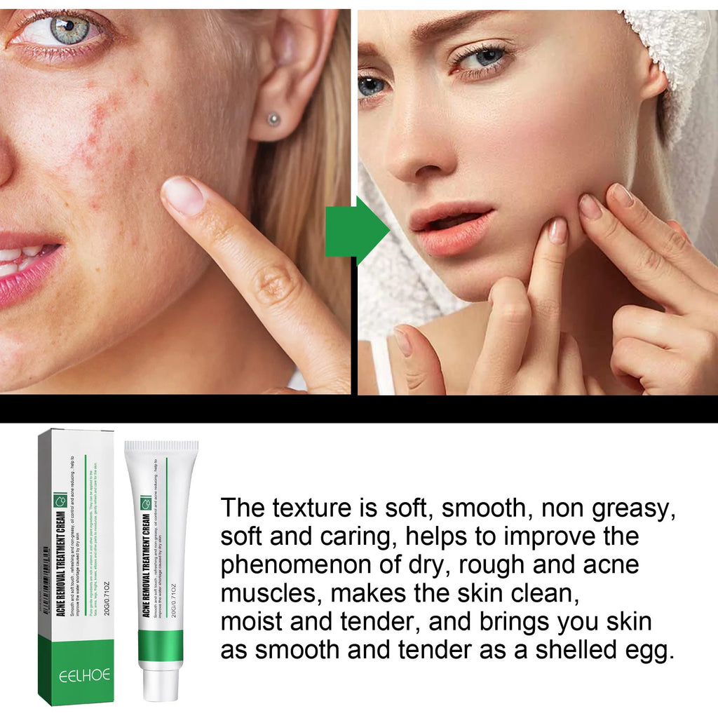 Skin Repair Cream Improves Dull Skin, Moisturizes and Cleanses Acne, Skin Repair and Care Cream