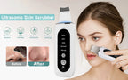Ultrasonic Skin Scrubber — Deep Pore Cleansing & Peeling Device