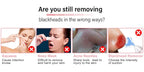Ultrasonic Skin Scrubber — Deep Pore Cleansing & Peeling Device