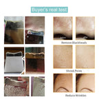 Ultrasonic Skin Scrubber — Deep Pore Cleansing & Peeling Device