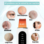 Ultrasonic Skin Scrubber — Deep Pore Cleansing & Peeling Device
