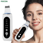 Ultrasonic Skin Scrubber — Deep Pore Cleansing & Peeling Device