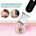 Ultrasonic Skin Scrubber — Deep Pore Cleansing & Peeling Device